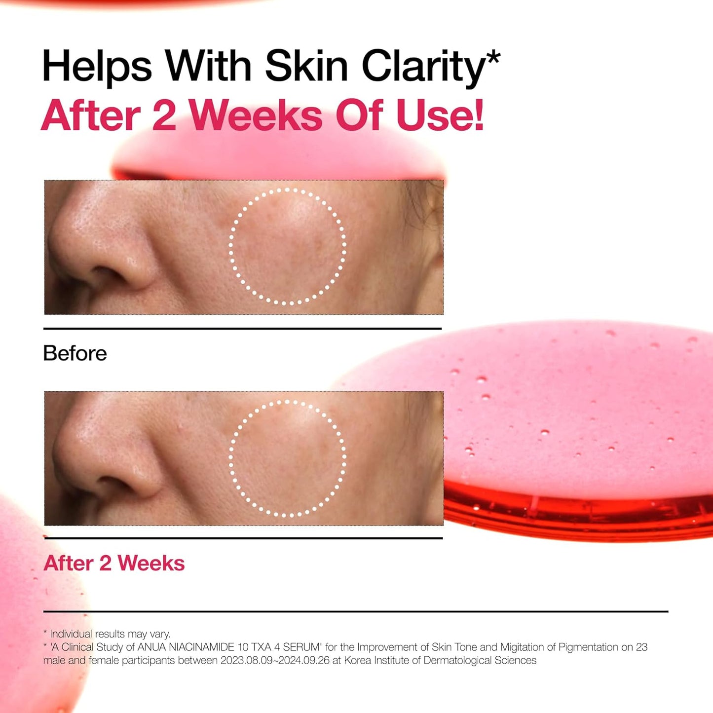 Anua Niacinamide 10 + TXA 4 Serum