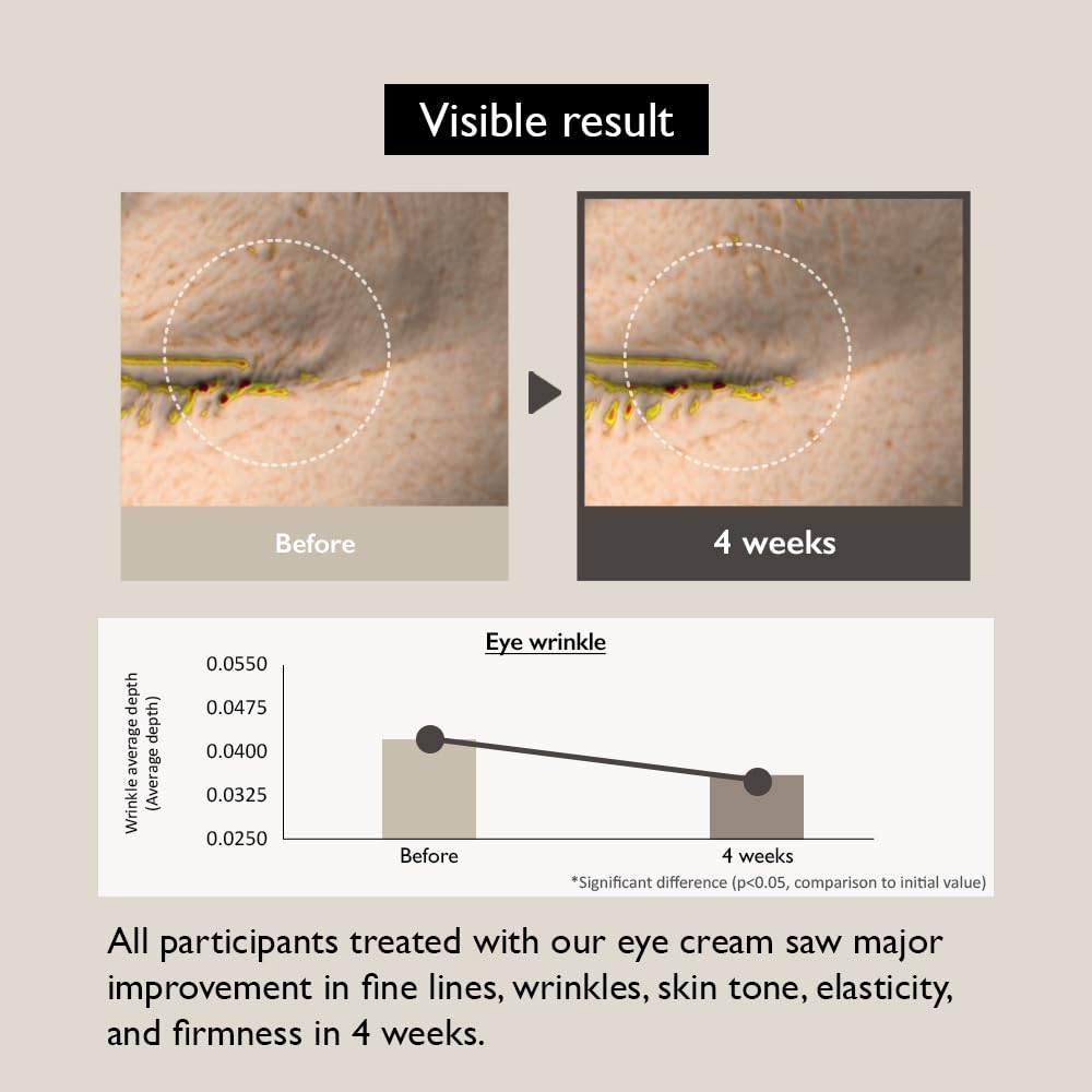 haruharu wonder Black Rice Bakuchiol Eye Cream & Black Rice Hyaluronic Anti-Wrinkle Serum Bundle