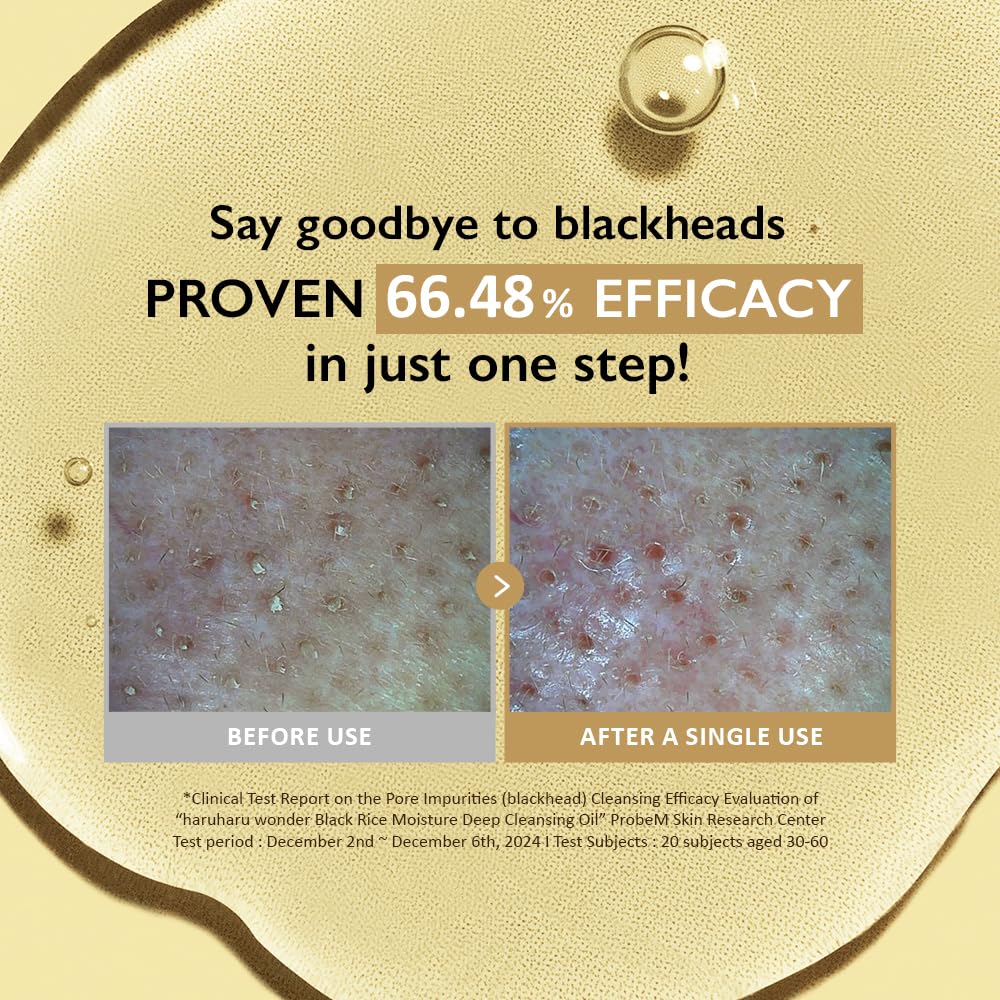 HARUHARU wonder Black Rice Moisture Cleansing Oil, Double Cleansing, Daily Makeup remover, Pore Oil Cleanser, Korean Skincare for sensitive, normal and Oily Skin, 5.1 fl oz