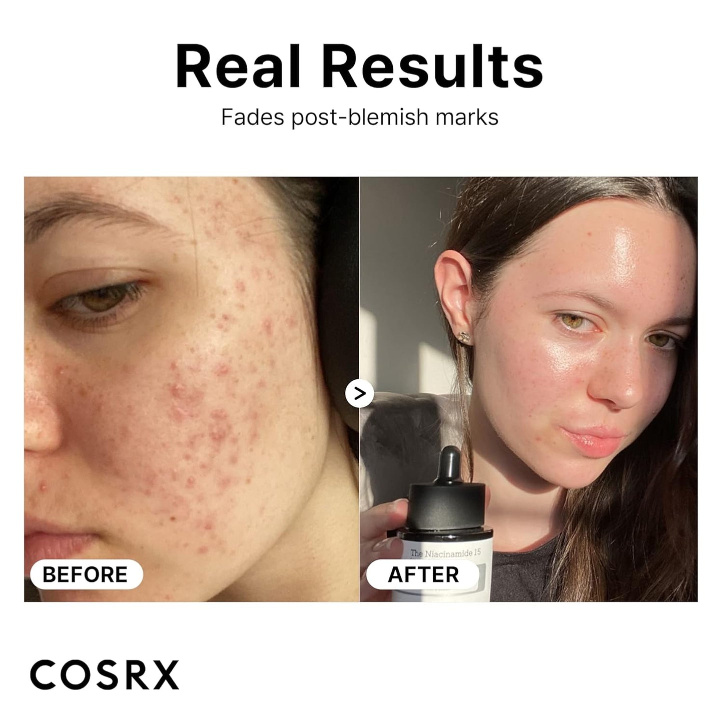 COSRX 15% Niacinamide Face Serum, Pore Minimizer Serum